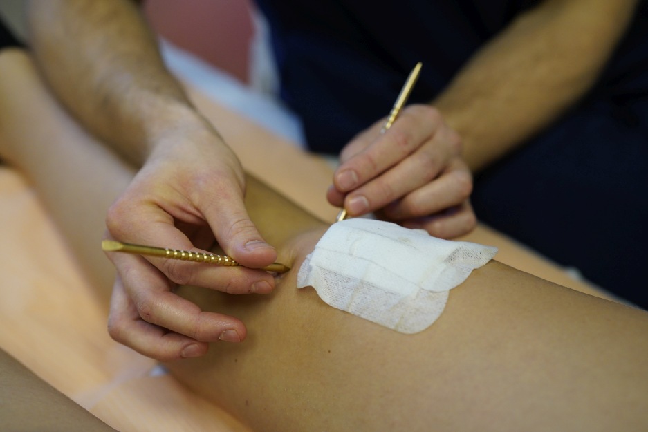 Terapia blizny